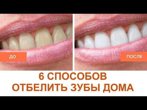 6 эффективных СПОСОБОВ отбелить зубы в домашних условиях