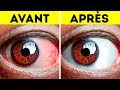 10+ Exercices Simples Pour Soulager Les Yeux Fatigués