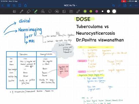 DOSE :Tuberculoma vs NCC