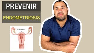 Prevenir Endometriosis