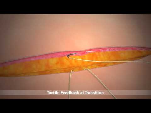 STRATAFIX Product Overview Animation CA