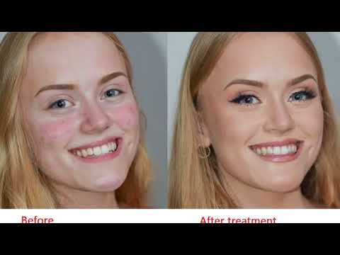 11-ways-to-use-natural-honey-bee-to-get-more-gorgeous-skin,-hair,-and-nails