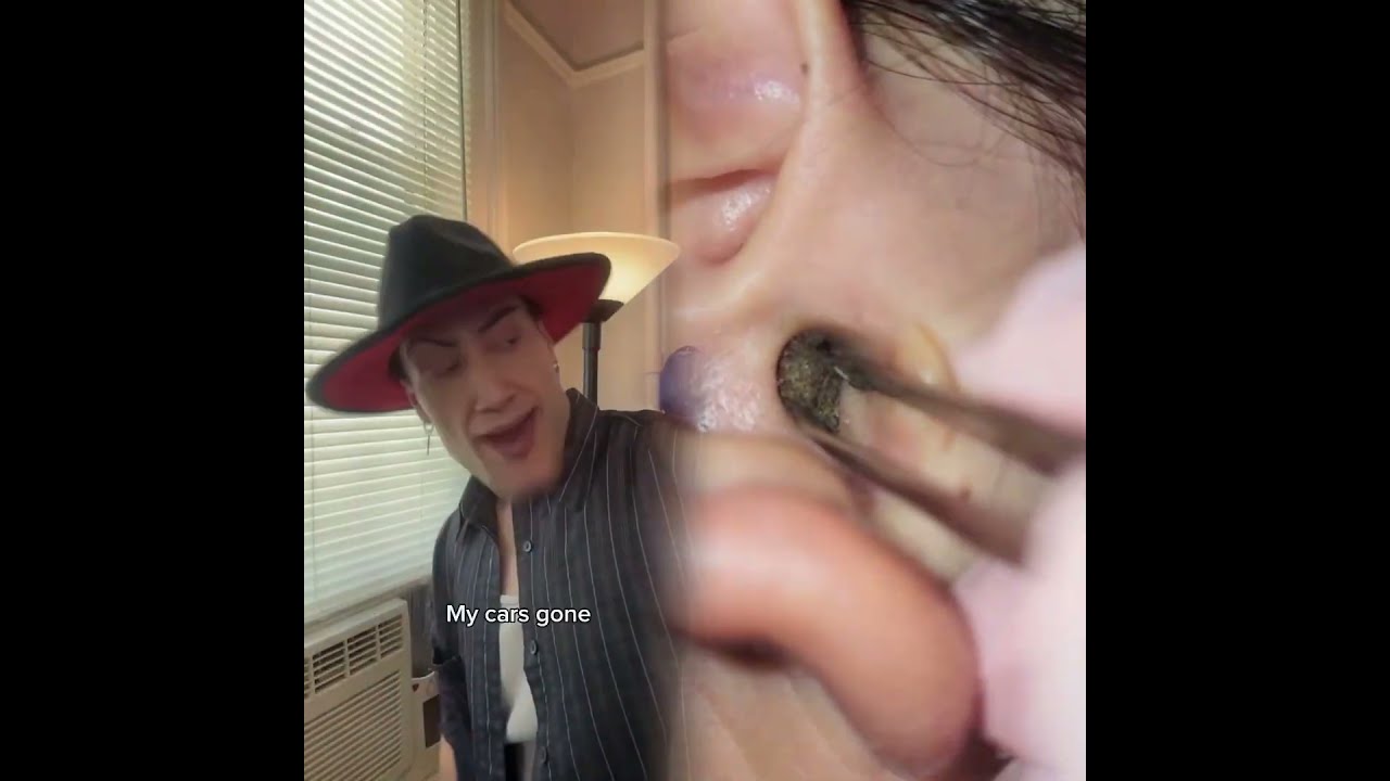  Pov Foryou Funny Acting Story Foryoupage Viral Skit Fyp Duet Tools