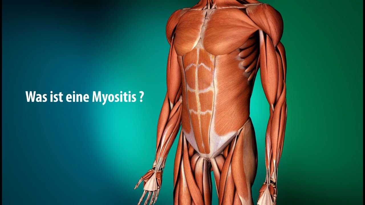 Erklärvideo Myositis