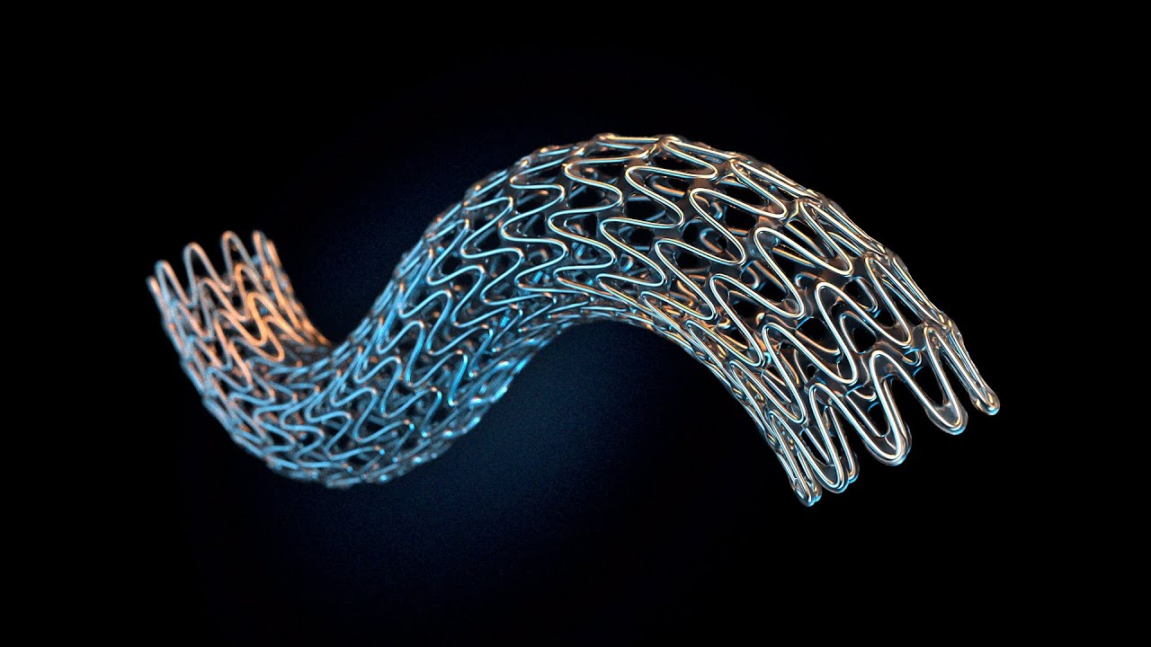 Стент видео. Silk+ стент. Стент MGUARD. Стент интракраниальный derivo 5х20mm, 01- 000332. Stent проекты 2022.