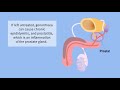 Sexual Health - Gonorrhoea (Male)