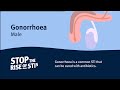 Sexual Health - Gonorrhoea (Male)