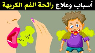 اسباب رائحة النفس الكريهة وعلاجها : رائحة فم كريهة من المعدة , اللوزتين, و الجيوب الانفية وغيرها