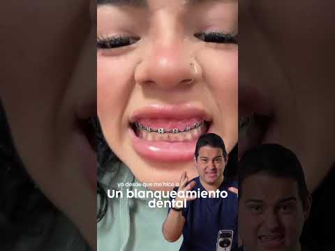 Qué pasó con sus ENCÍAS 😳