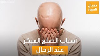صباح العربية | سبب وراثي أو تغييرات هرمونية.. أبرز أسباب الصلع المبكر الأكثر شيوعًا عند الرجال