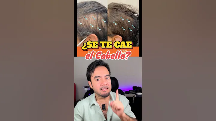 How to Help Stop Hair Loss. REVITA Conditioner. Does It Work?