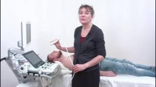 Echocardiography Essentials: Mastering the suprasternal view of the aorta