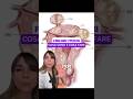 FIBROMI UTERINI: Cosa sono? e cosa fare? #ginecologia #donne #salute #health #women