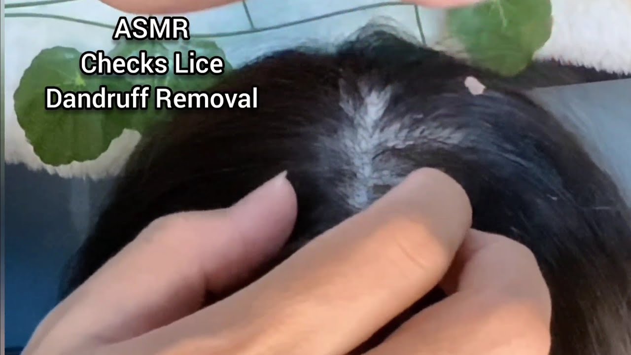 Calm Check ASMR Calm Checks Lice and Dandruff Removal to help you for asleep | No ...