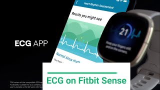 fitbit sense ecg europe