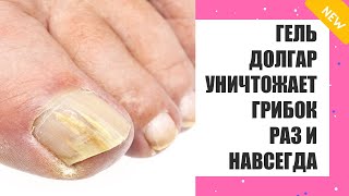 Лак для ногтей от грибка какой лучше