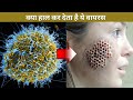 5 Deadliest viruses in history || दुनिया में मौजूद सबसे खतरनाक वायरस