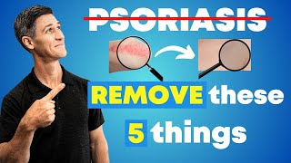 5 Things to Stop Now if You Have Psoriasis