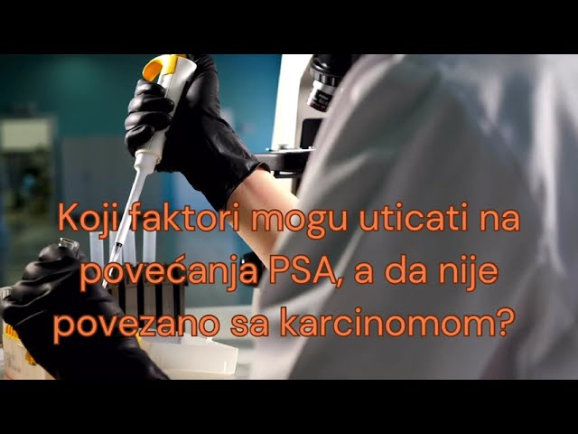 Da li je PSA test dovoljan za detekciju karcinoma prostate?