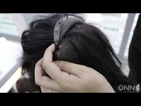 Seyrek Saçlı Kadınlar İçin Tuping Sistemi ( Protez Saç )