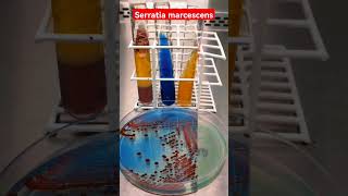 Serratia marcescens on CLED Agar - Urine culture #Microbiology