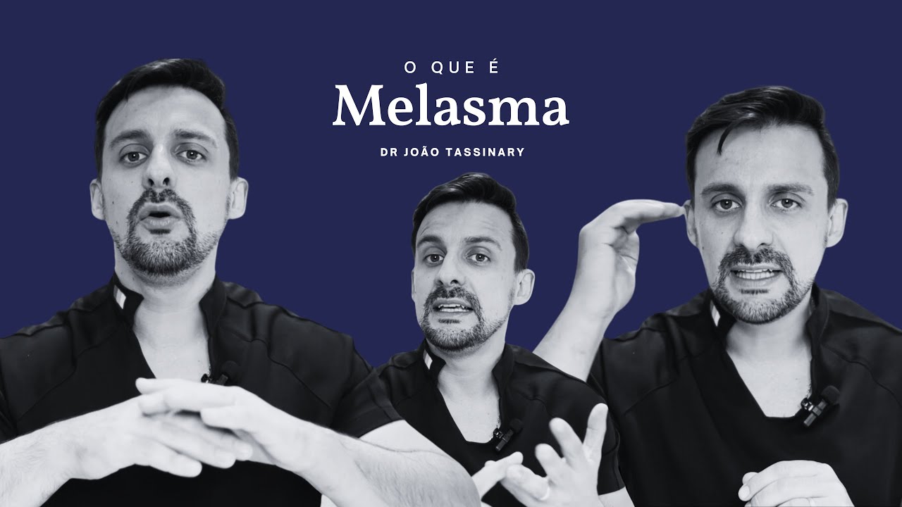 O que é melasma? Como tratar? | Dr. João Tassinary