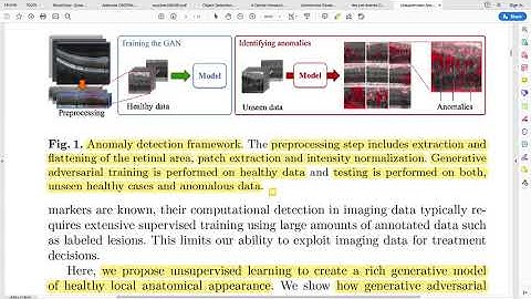 Unsupervised Anomaly Detection withGenerative Adversarial Networks to GuideMarker Discovery