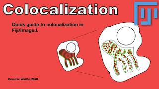 Celebrity Quick guide to colocalization in Fiji/ImageJ Wealth