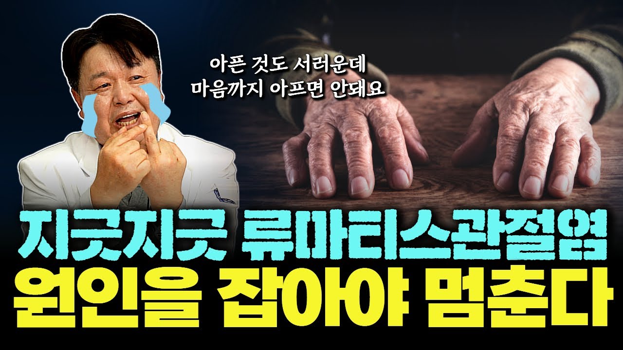 [집중! 류마티스관절염 4배나 높이는 원인이 있다고?!] 이명수 원광대병원 류마티스내과 교수