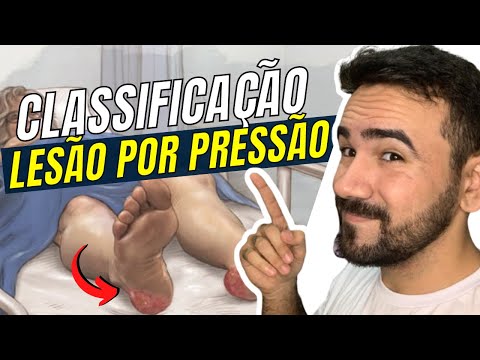 Vídeo: Qual é o problema LPP?