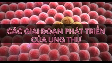 Các giai đoạn phát triển của ung thư | Alo bác sĩ Chuyên trang Tạp chí Sức khoẻ Cộng đồng