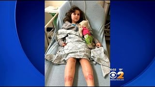 Bitter Blast Brings Record Cold, Injures Girl