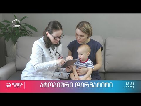 რა იწვევს ატოპიურ დერმატიტს, რატომ არის გახშირებული ბავშვებში და როგორია მისი მკურნალობის მეთოდები