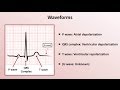 Intro to EKG Interpretation - Waveforms, Segments, and Intervals