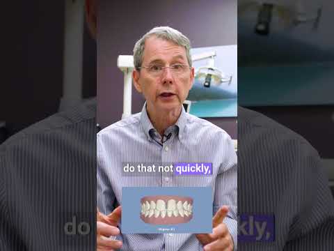 When Do Your Teeth Start Moving With Invisalign