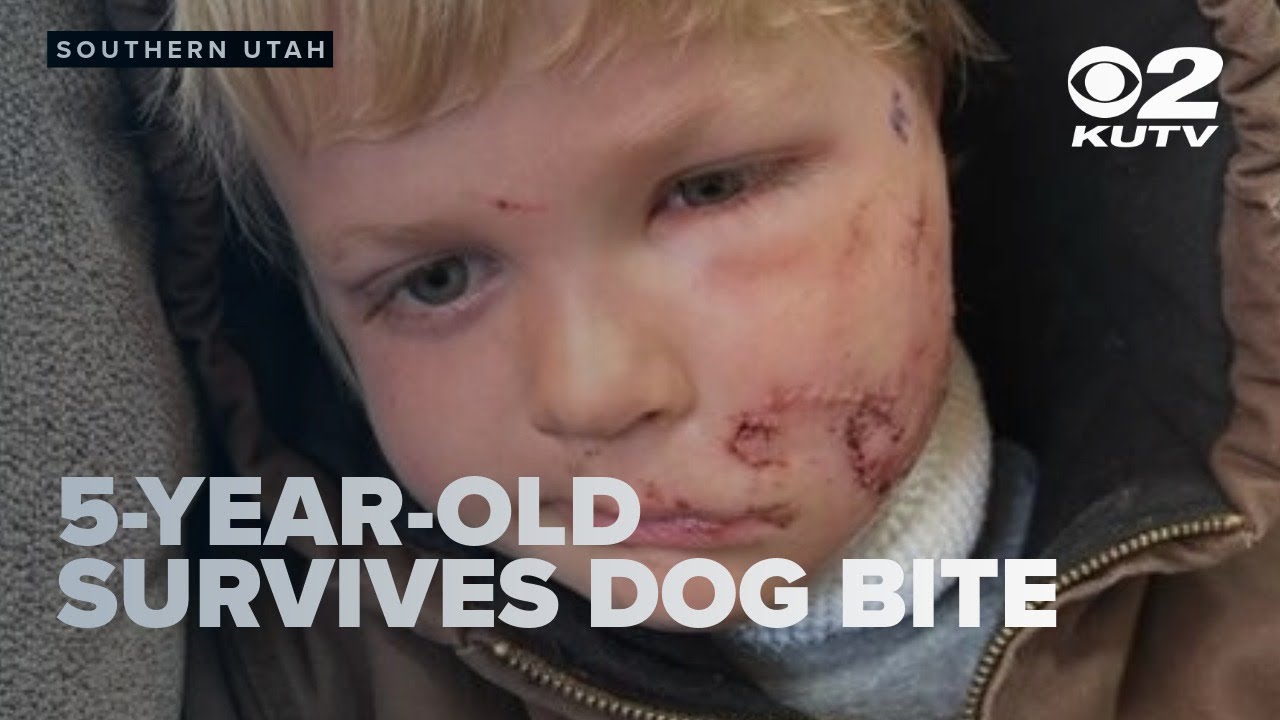 Boy bitten in face by dog during Southern Utah attack - YouTube