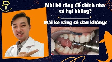 Mài kẽ răng để chỉnh nha có hại không?