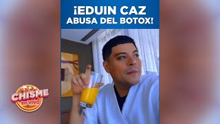 💉 Eduin Caz cachado con Botox demás y levanta Críticas | Chisme en Vivo