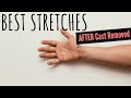 After Cast Removed from Hand/Wrist: BEST Stretches for Success