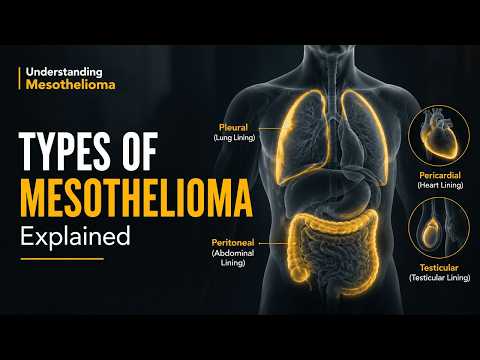 Big Spring Mesothelioma Legal Questionblog Posts