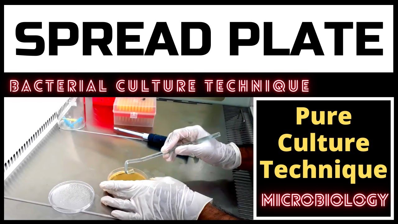 Spread Plate Technique For Colony Counting_A Complete Procedure (Microbiology)
