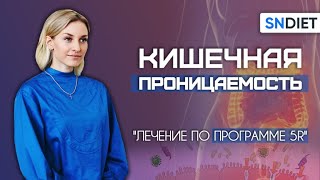 Синдром повышенной кишечной проницаемости. Как питаться и какие добавки принимать?