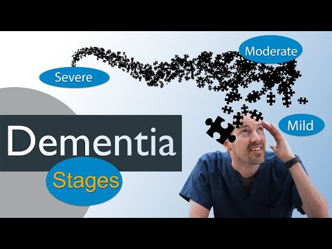 Stages of dementia and treatment