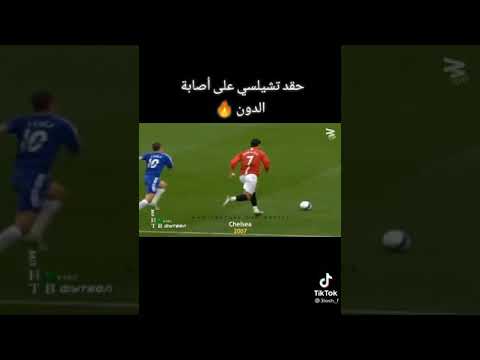 أصابة كرستيانو رونالدو مع مانشستر يونايتد