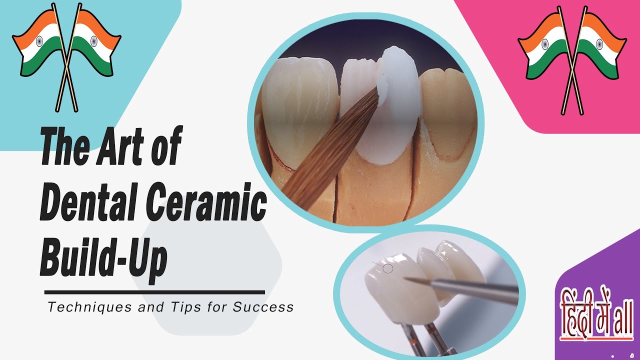 The Art of Dental Ceramic BuildUp 🖌 Techniques and Tips for Success