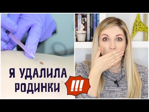 Папилломы чешутся что делать