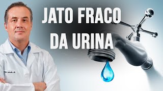 ESTOU URINANDO MAIS FRACO, O QUE PODE SER?  Dr. André Matos Urologista