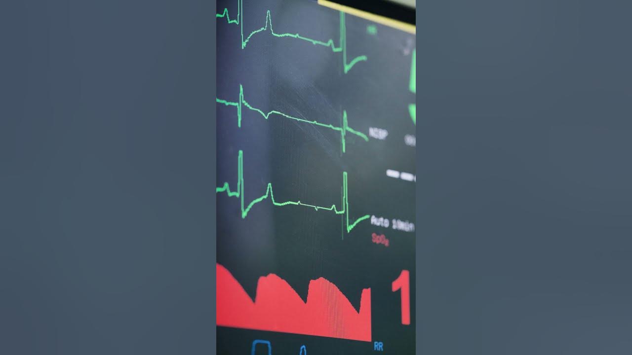 Heart monitor normal beep sound effect shorts YouTube