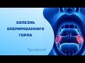 Болезнь оперированного горла