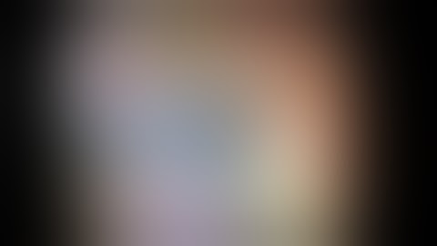 Endoscopic Submucosal Dissection Using Head-mounted Display